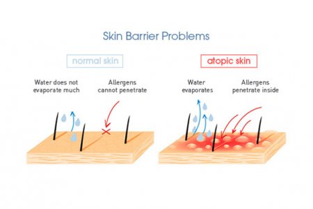 Bőr barrier probléma minták
