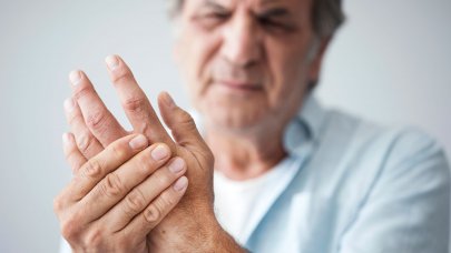 Allergiás bőr és a sérült kezek